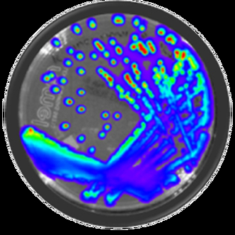 Salmonella typhimurium - Xen 33